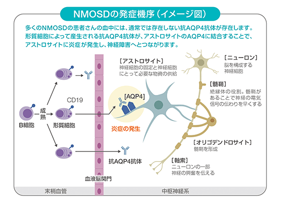 NMOSDの発症機序（イメージ図）