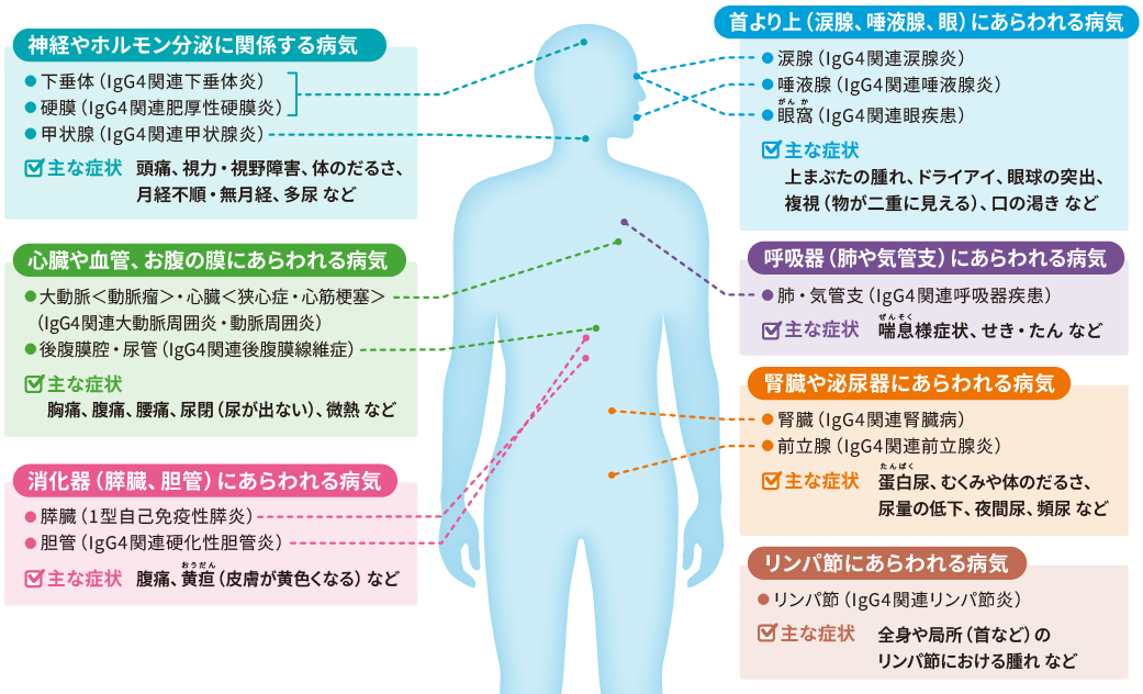 IgG4関連疾患の病変が認められる部位の説明画像