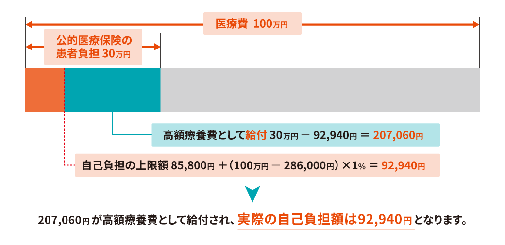 高額療養費制度の仕組みを示す図