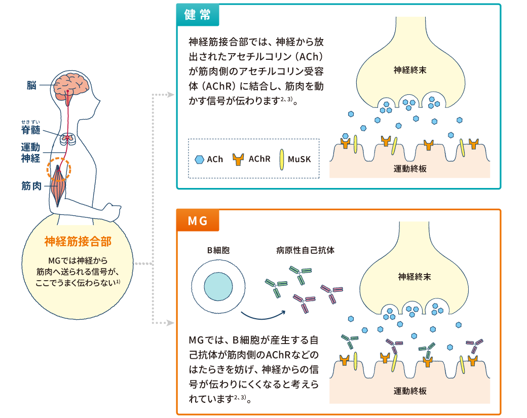 MGとは