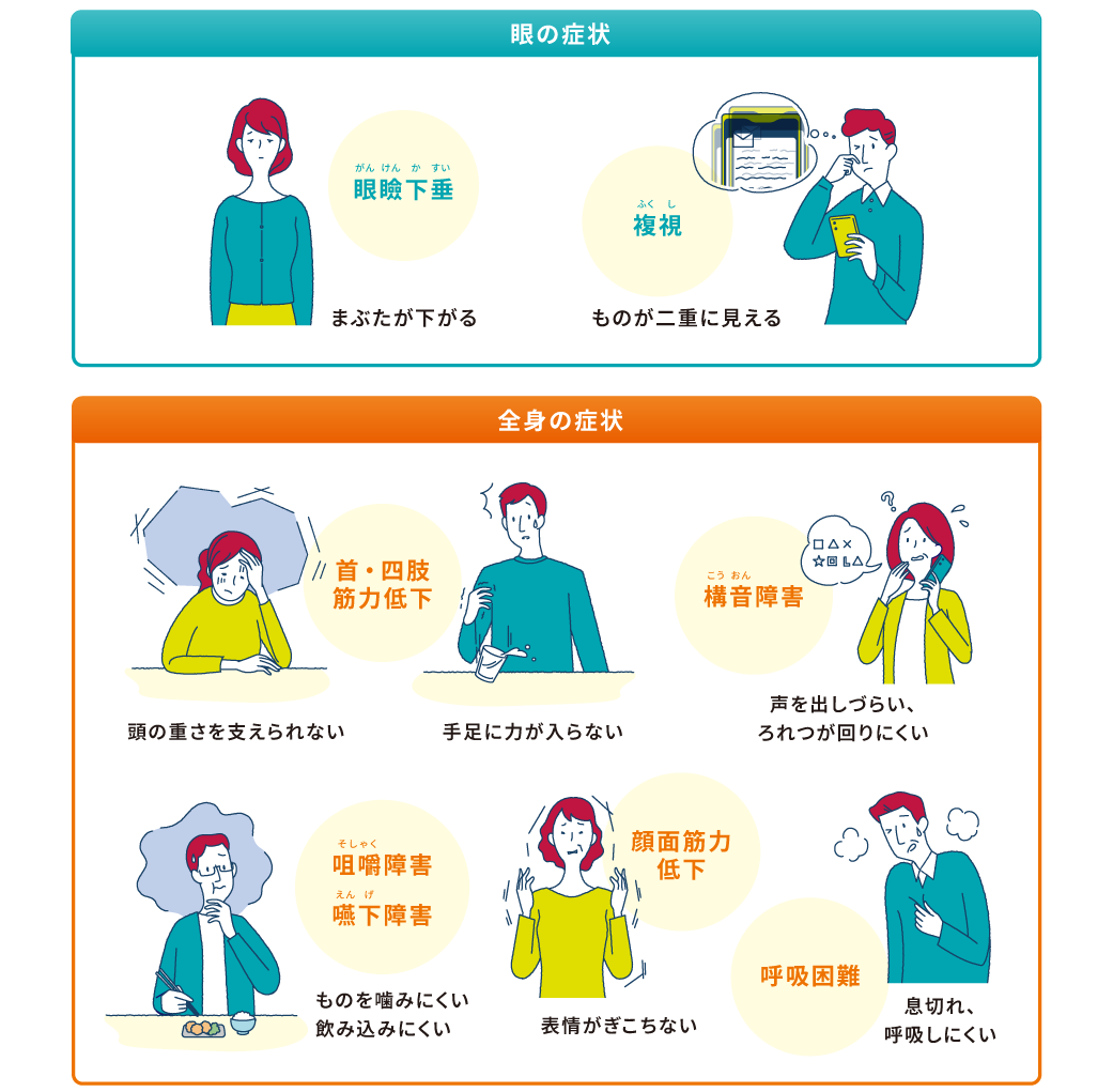 MGの主な症状